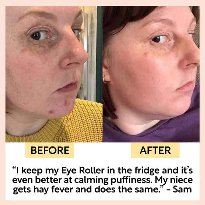 UpCircle Eye Roller