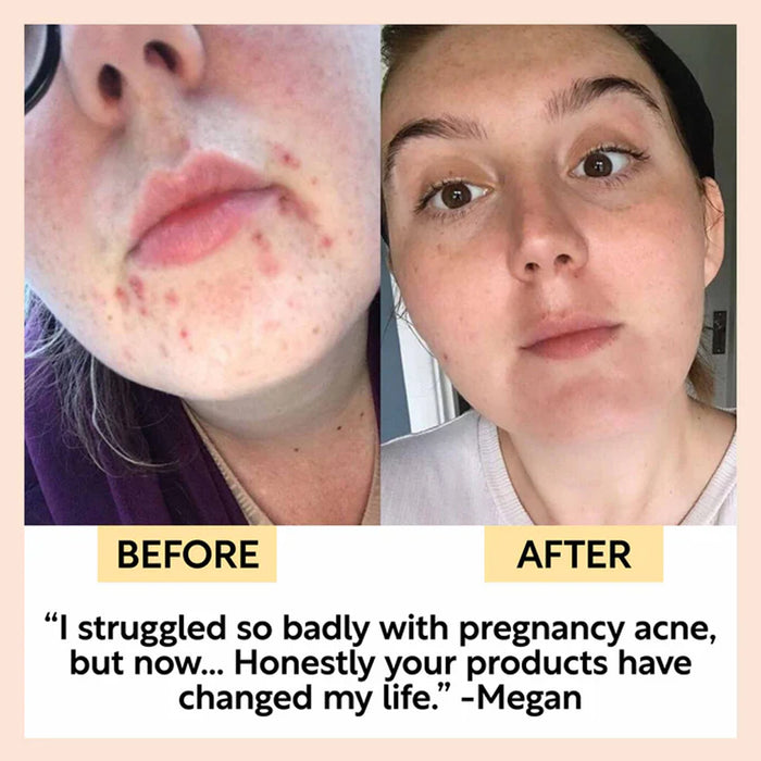 UpCircle Face Moisturiser With Vitamin E & Aloe Vera