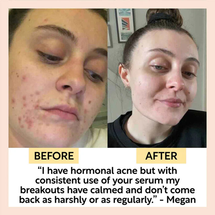 UpCircle Face Oil With Coffee, Rosehip & Jojaba